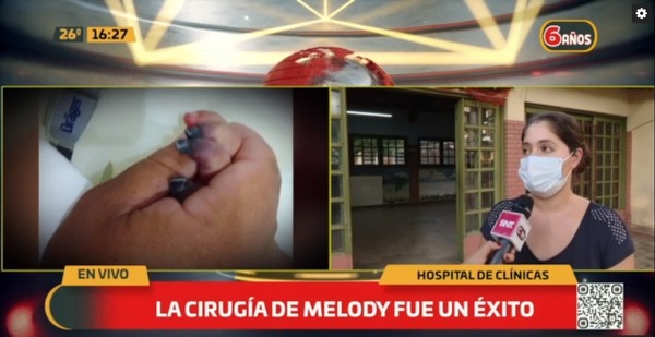 A la espera de implantes ya extrajeron los dedos afectados de Melody - C9N
