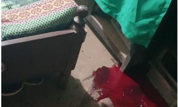 Sicarios asesinan a tiros a un hombre en Karapa’i