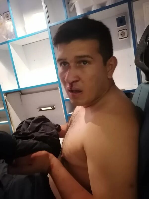 Policía herido en incidente de hinchas de Luque tras el encuentro con Libertad - Policiales - ABC Color