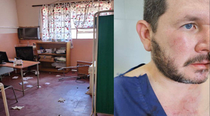 Diario HOY | Equipo de ecografía quedó dañado tras ataque a médico en el Hospital de Limpio
