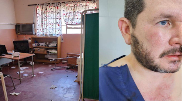 Diario HOY | Equipo de ecografía quedó dañado tras ataque a médico en el Hospital de Limpio