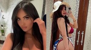 Modelo se hace cirugía para tener la cola más grande que la de Kim Kardashian y no puede caminar