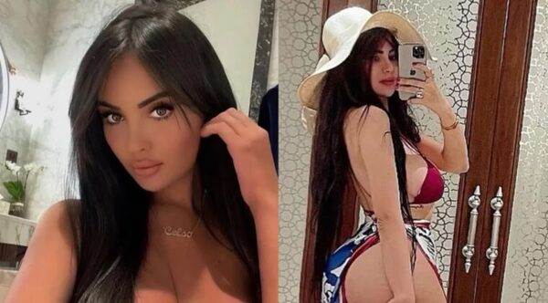 Modelo se hace cirugía para tener la cola más grande que la de Kim Kardashian y no puede caminar