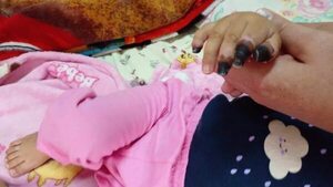 Melody: amputaron sus dedos a la pequeña de 9 meses que sufrió de presunta negligencia médica - Nacionales - ABC Color