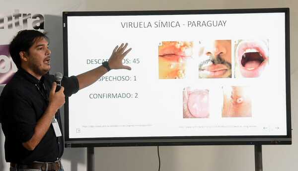 No se reportan nuevos casos confirmados de viruela símica en Paraguay - .::Agencia IP::.