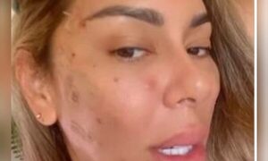 Exdoña del “Pájaro” rejuveneció su rostro tras polémica separación