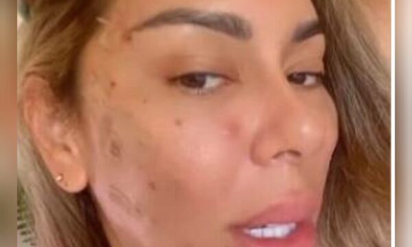 Exdoña del “Pájaro” rejuveneció su rostro tras polémica separación