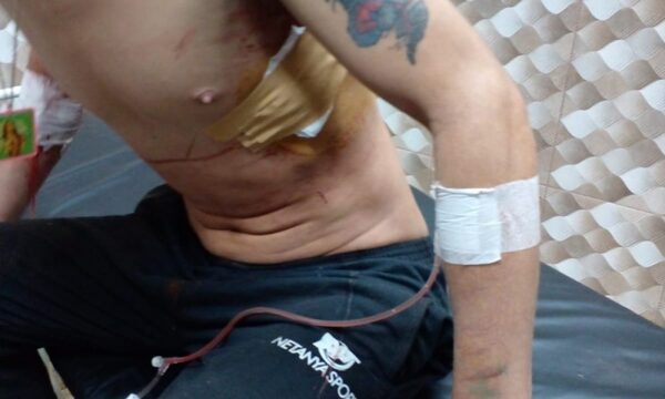 Travesti hiere a su hermano durante ronda de tragos en Hernandarias