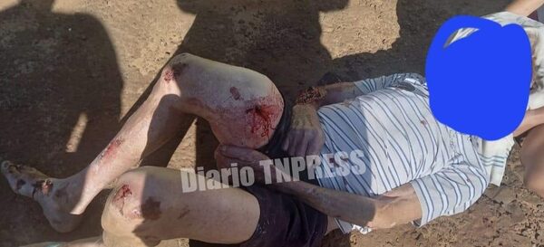 Camión repartidor de mercaderías arrolla a un septuagenario en Hernandarias – Diario TNPRESS