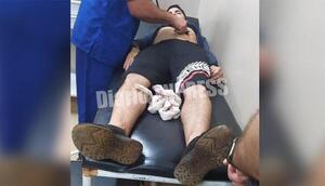 Motochorros a puñalana joven para robarle su celular en Minga Guazú – Diario TNPRESS