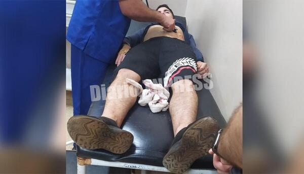 Motochorros a puñalana joven para robarle su celular en Minga Guazú – Diario TNPRESS