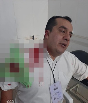 Apoderado de la ANR fue agredido en Sapucái | 1000 Noticias