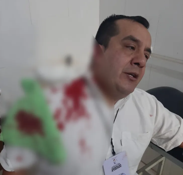 DOS DETENIDOS POR ARRANCAR PARTE DE LA OREJA A APODERADO COLORADO - Itapúa Noticias