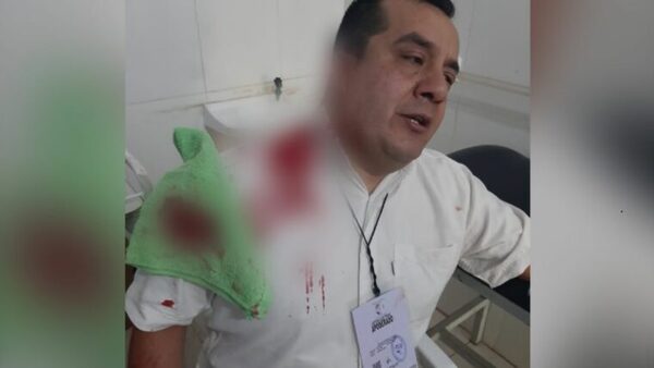 Diario HOY | Dos detenidos tras arrancar parte de la oreja de apoderado de la ANR