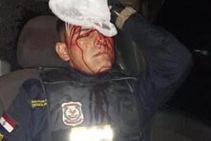 Policía sufrió heridas al ser alcanzado por piedra lanzada por “payistas” – Diario TNPRESS