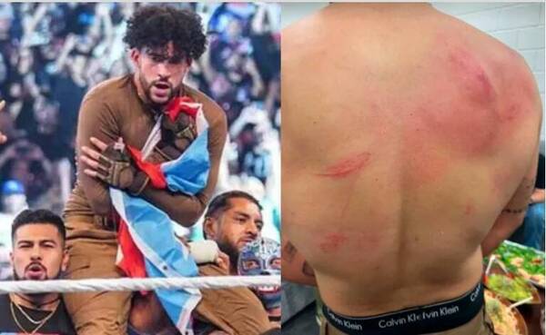 Bad Bunny mostró cómo quedó su espalda luego de la moqueteada