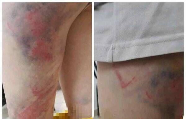 ¡Terrible! La acusan de hacer arrodillar a su nieto en la calle y golpearlo con madera