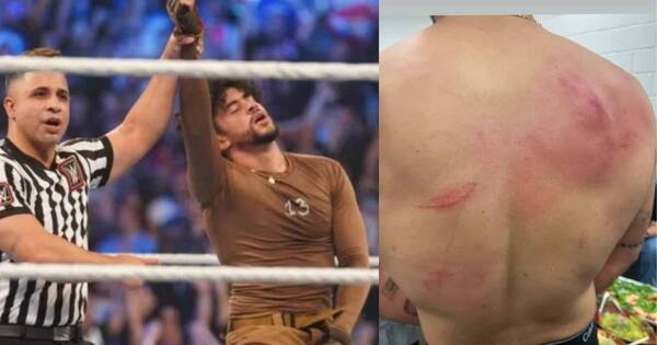 La Nación / ¡Con moretones y arañazos! Así quedó Bad Bunny tras pelea en la WWE