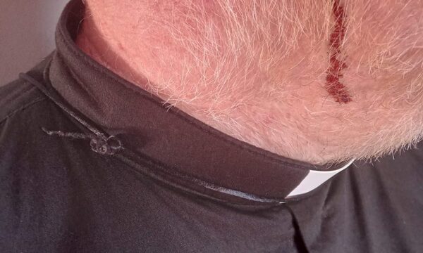 Vándalos agreden con palos a sacerdote en medio de protesta – Diario TNPRESS