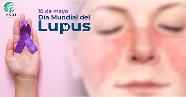 Fundación Tesãi recuerda el Día Mundial del Lupus | DIARIO PRIMERA PLANA