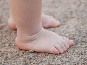 Diario HOY | ¿Pueden los niños enfermarse por andar descalzos? Especialista responde
