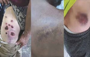 Denuncian detenciones arbitrarias, agresión policial y otras irregularidades en protestas – Prensa 5