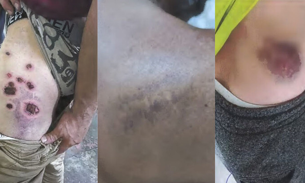 Denuncian detenciones arbitrarias, agresión policial y otras irregularidades en protestas - OviedoPress