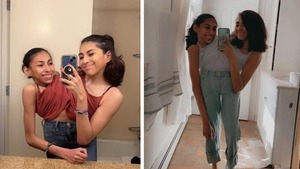Una siamesa influencer inició una relación y tiene un acuerdo con su hermana sobre tener intimidad con su pareja