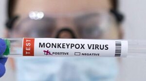 VIRUELA DEL MONO: OMS LEVANTA LA ALERTA MÁXIMA MUNDIAL - Itapúa Noticias