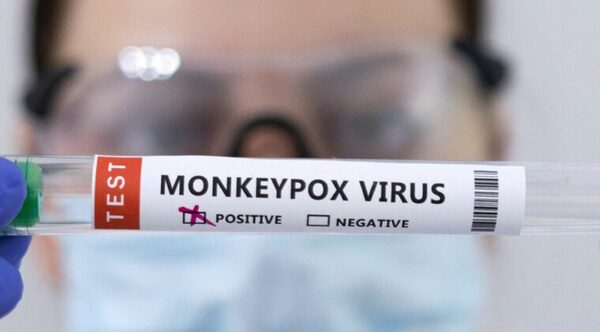 VIRUELA DEL MONO: OMS LEVANTA LA ALERTA MÁXIMA MUNDIAL - Itapúa Noticias