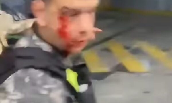 (VIDEO)Enfrentamiento de barras tras el súperclásico: Desfiguraron la cara de un poli con piedras
