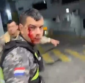 Lince herido por defender a un hincha de Cerro de barrabravas de Olimpia “está bien y en su casa” - Policiales - ABC Color