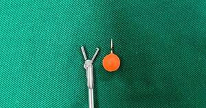 La Nación / Médicos extraen piercing de un niño de 12 años en Clínicas