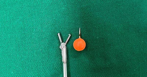La Nación / Médicos extraen piercing de un niño de 12 años en Clínicas