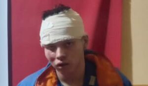 Su revólver hizo varios clic pero no disparó, y motochorro sufrió golpiza y abandono
