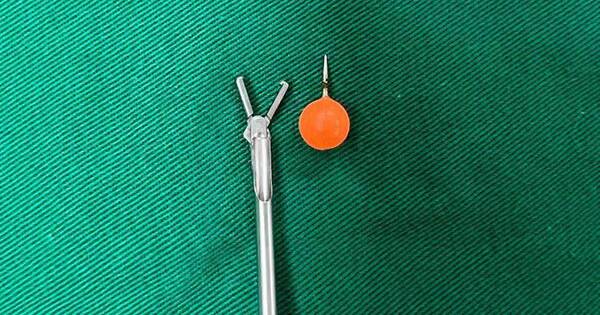 La Nación / Extraen piercing atascado en un niño