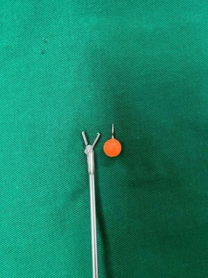 Extraen piercing atorado en tráquea de niño de 12 años