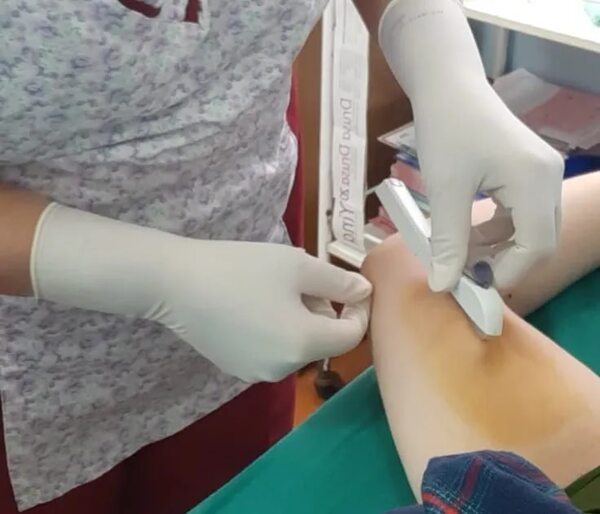 Implante subdérmico disponible para menores de 19 años en Hospital Regional de CDE - ABC en el Este - ABC Color