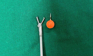 Médicos extraen piercing de un niño de 12 años en el Hospital de Clínicas - OviedoPress
