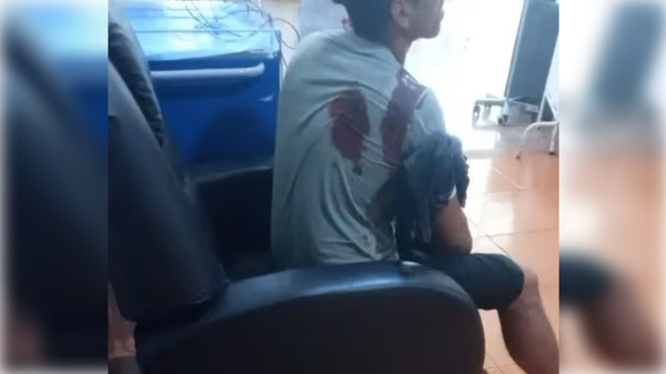 Pescador “pescó” una bala perdida