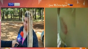 Mujer denuncia que fue atropellada por policía ebrio - Noticias Paraguay