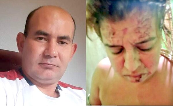 Prepotente y borracho policía atropelló a madre de familia y no se hace cargo