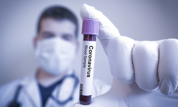 Hisopado positivo prolongado no implica que el COVID-19 siga siendo contagioso | 1000 Noticias