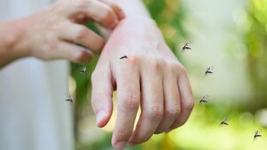 Diario HOY | Revelan qué olores hacen a las personas más 'apetecibles' para los mosquitos