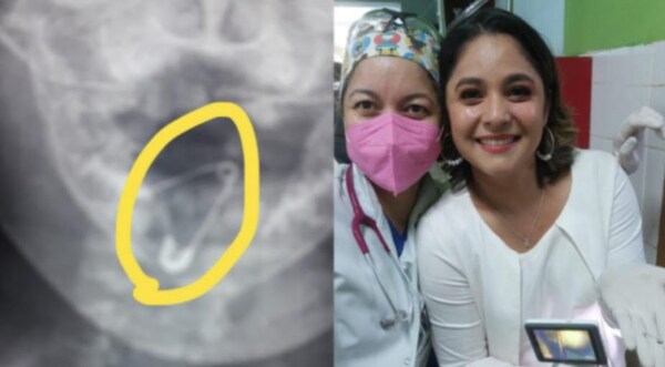 Doctoras salvan la vida a beba que tragó un prendedor - Noticiero Paraguay