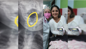 ¡Capísimas! Dos doctoras lograron salvar a una beba que tragó un prendedor abierto