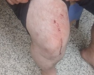 Diario HOY | Tres ladrones asaltaron e hirieron a chofer de Bolt, una joven quedó detenida