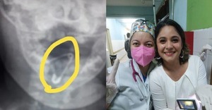 Médicas salvan a una bebé que tragó un prendedor - Unicanal