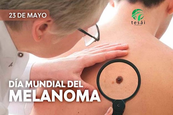 Fundación Tesãi celebra el Día Mundial contra el Melanoma | DIARIO PRIMERA PLANA