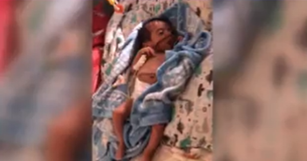 El pequeño Joshua se aferra a la vida - C9N